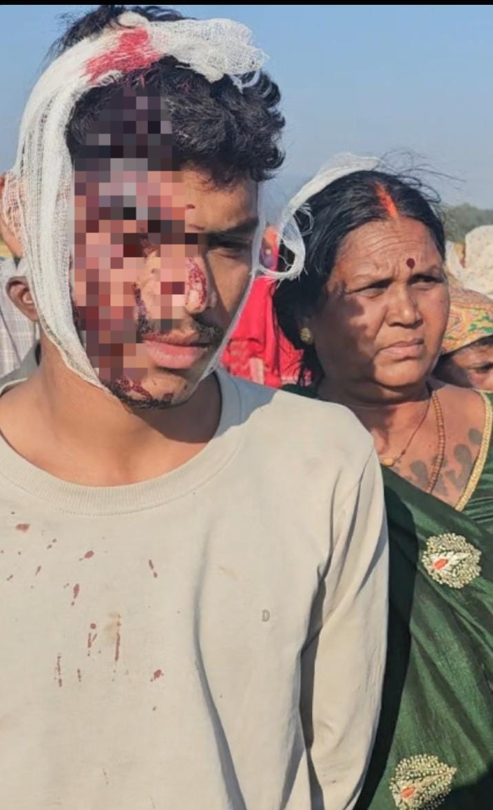 अमेरा खदान विस्तार को लेकर के ग्रामीण एवं पुलिस के बीच खूनी संघर्ष। अमेरा खदान विस्तार को लेकर के ग्रामीण एवं पुलिस के बीच खूनी संघर्ष।